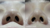 非開放鼻先手術